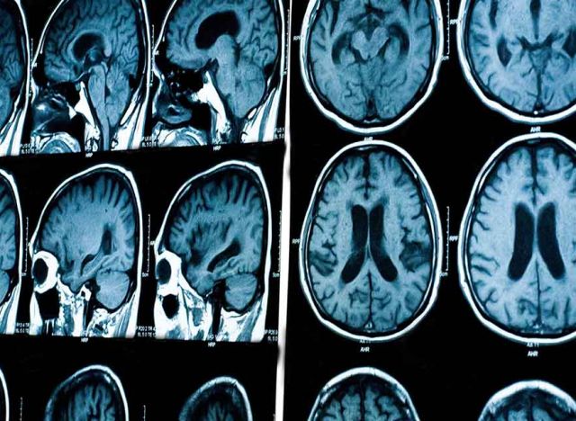 image of mris