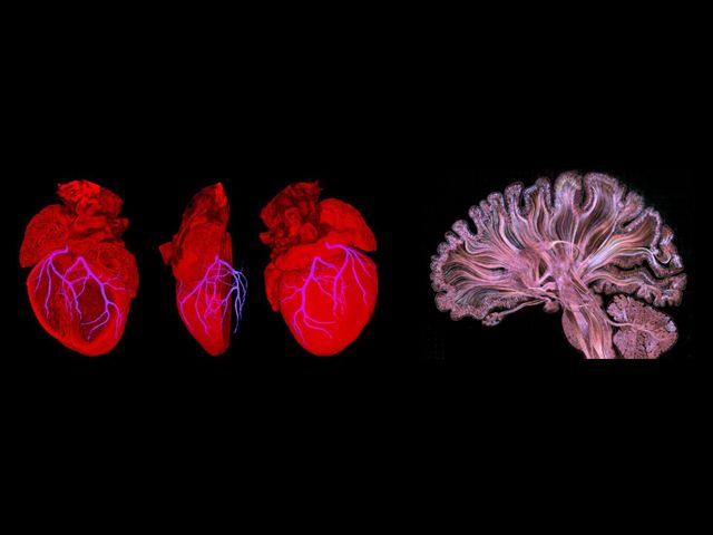 Research Initiative – Nina Miolane and the Bioshape Lab