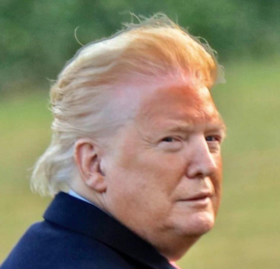 Trump, shown with a stark tan line on his face