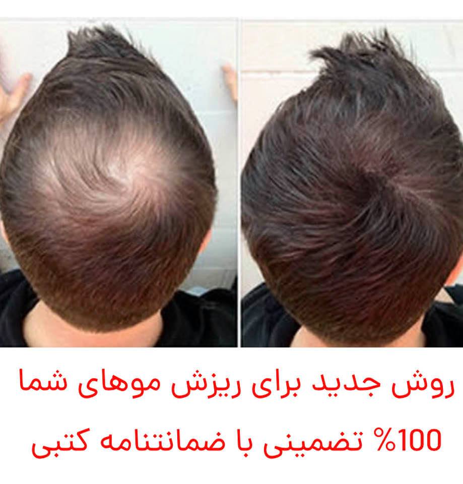 Linguistic faux pas: This Persian ad announces a new method for losing hair! We mostly need new methods for keeping or growing hair!